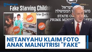 Perdana Menteri Israel Benjamin Netanyahu Klaim Foto Anak Malnutrisi sebagai Fitnah terhadap Yahudi
