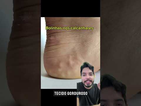 Mathias Gama De Aguiar Ferreira-7