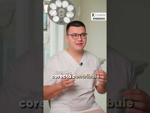 Care sunt Beneficile Implanturilor?