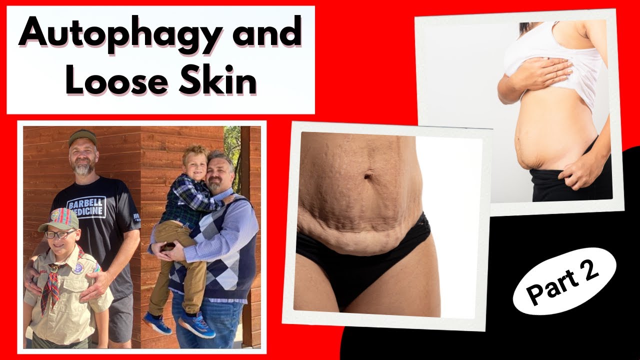 Fasting, Autophagy, and Reducing Loose Skin