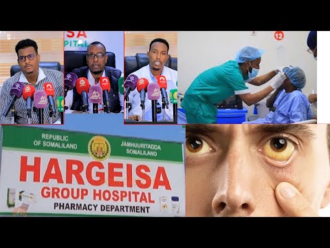 Cusbitaalka Guud ee Hargeysa oo Adeegyo Indhaha Oo Bilaash ah ka bilaabmayaan