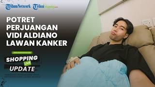 Hidup dengan 1 Ginjal, Potret Perjuangan Vidi Aldiano Lawan Kanker, Rutin Jalani Kemoterapi