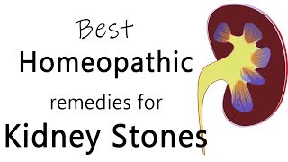 Best homeopathic medicine for stone in kidney - Dr