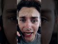 Car Crash Call Skit Funny Comedy
