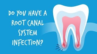 Do You Have a Root Canal System Infection?