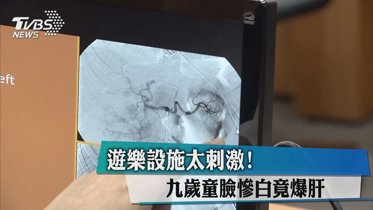 遊樂設施太刺激 男童肝腫瘤爆裂大出血