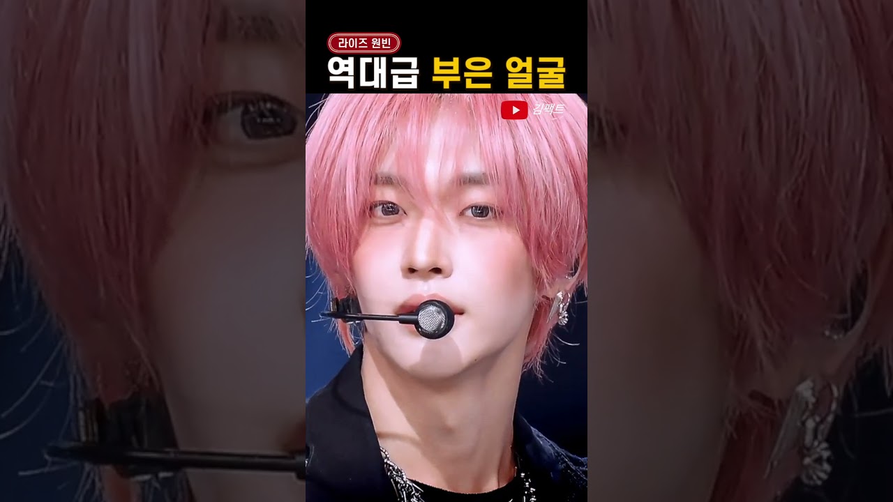 '역대급 부었다는' 원빈 얼굴 상태