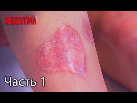 Как отбеливать лицо срочно Черные волосы и конопушки