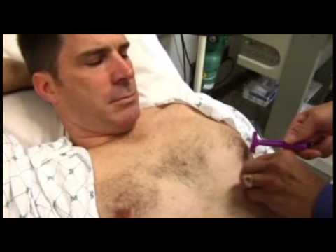 CardioSmart | Dobutamine Stress Echocardiogram