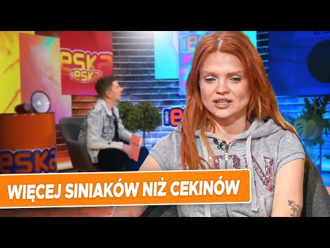Nie zawsze są same cekiny, czasem są też siniaki | Margaret w RADIO ESKA