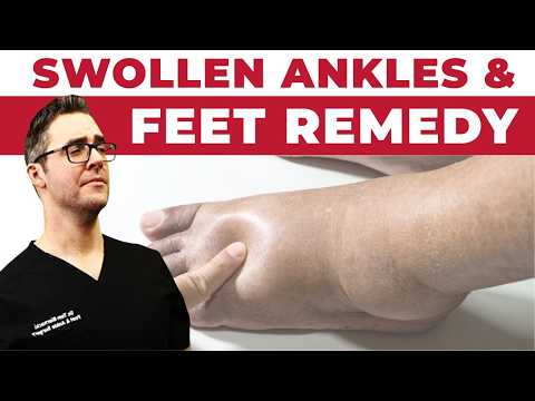 Heel Spurs Plantar Fasciitis BEST Home Treatment 2022