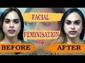 Milla S Facial Feminisation Milla Babygal