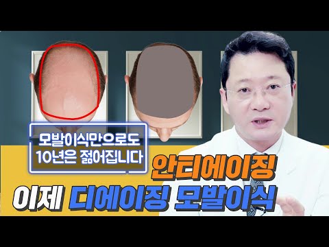 대량모발이식으로 10년은 젊어 지는 디에이징 모발이식