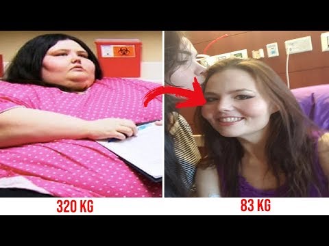 Pierderea în greutate colonică înainte și după