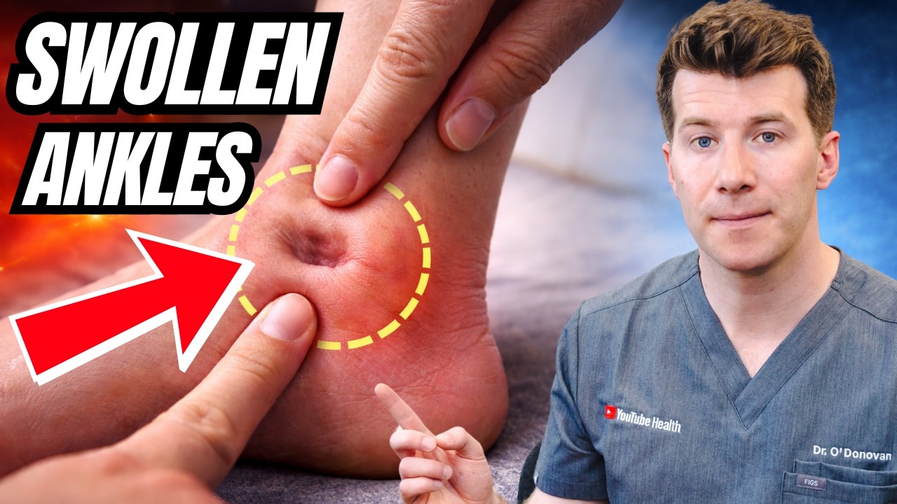10 causes of Swollen Ankles | Doctor explains