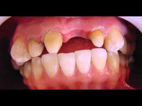 SALUD ODONTOLOGICA INTEGRAL