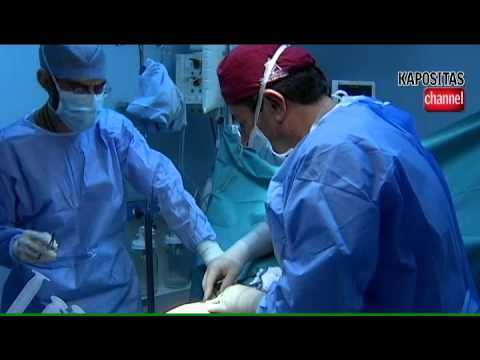 Brazilian Butt Lift-BBL:UK=Greece=Cyprus:Dr Kapositas,M.D,PhD