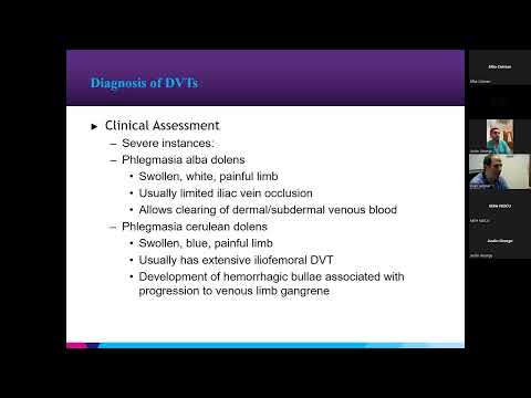 Deep Vein Thrombosis: A Modern Approach