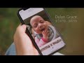 Bronson Mothers Milk Bank Dylan S Story
