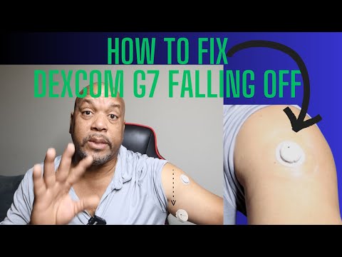 Dexcom G7 Falling Off