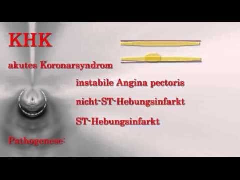 Innere Medizin ─ Koronare Herzkrankheiten KHK