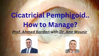 Cicatricial Pemphigoid.. How to Manage? Prof. Ahmed Bardan with Dr. Amr Mounir 