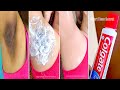 Apply Toothpaste on Your Dark Underarm and See the Magic | Dark Underarms Whitening