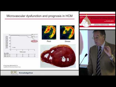 P Camici   Pathophysiology of pf coronary microvascular dysfunction in primary and secondary LVH