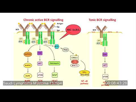 Saudi Lymphoma Myeloma 13 Lymphoma in the era of precision Oncology