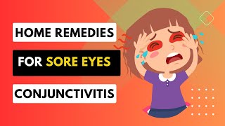 Natural Remedies To Treat Sore Eyes (Home Remedies for Conjunctivitis)