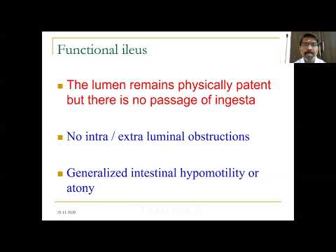 Paralytic ileus in bovine its differential diagnosis and therapeutic management