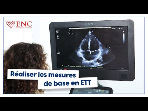 Tuto ENC : comment réaliser les mesures de base en ETT ?