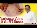 Varicose Veins में हो रही है दिक्कत Hakim Suleman Khan Sadhna TV