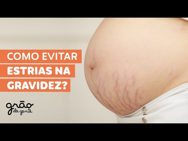O QUE VOCÊ PRECISA SABER SOBRE ESTRIAS NA GRAVIDEZ