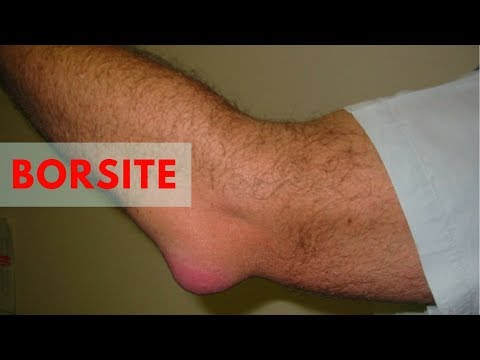 Gap caviglia deltoide legamento guarisce molti Inferiore segno il mal di schiena di gravidanza per ritardare forum