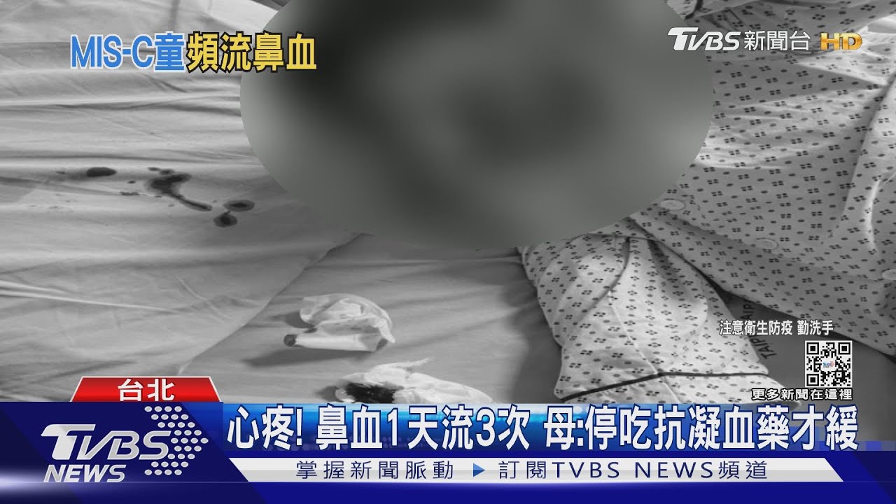 肝指數高、心臟動脈粗 男童MIS-C「手黑、噴鼻血」