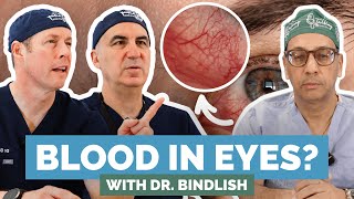 Why Is Your Eye Bloody? Might Be A Hyphema. Doctors Break It Down