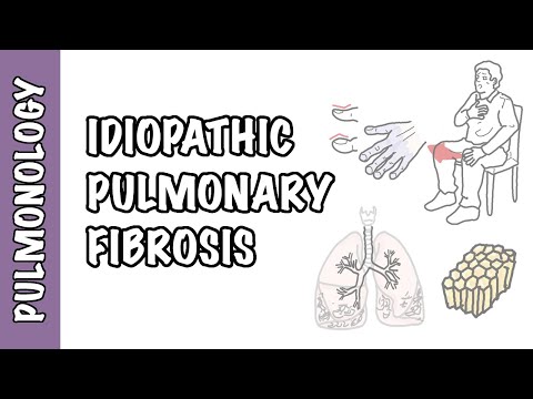 Idiopathische Lungenfibrose - Pathophysiologie, Anzeichen und Symptome, Untersuchung und Behandlung