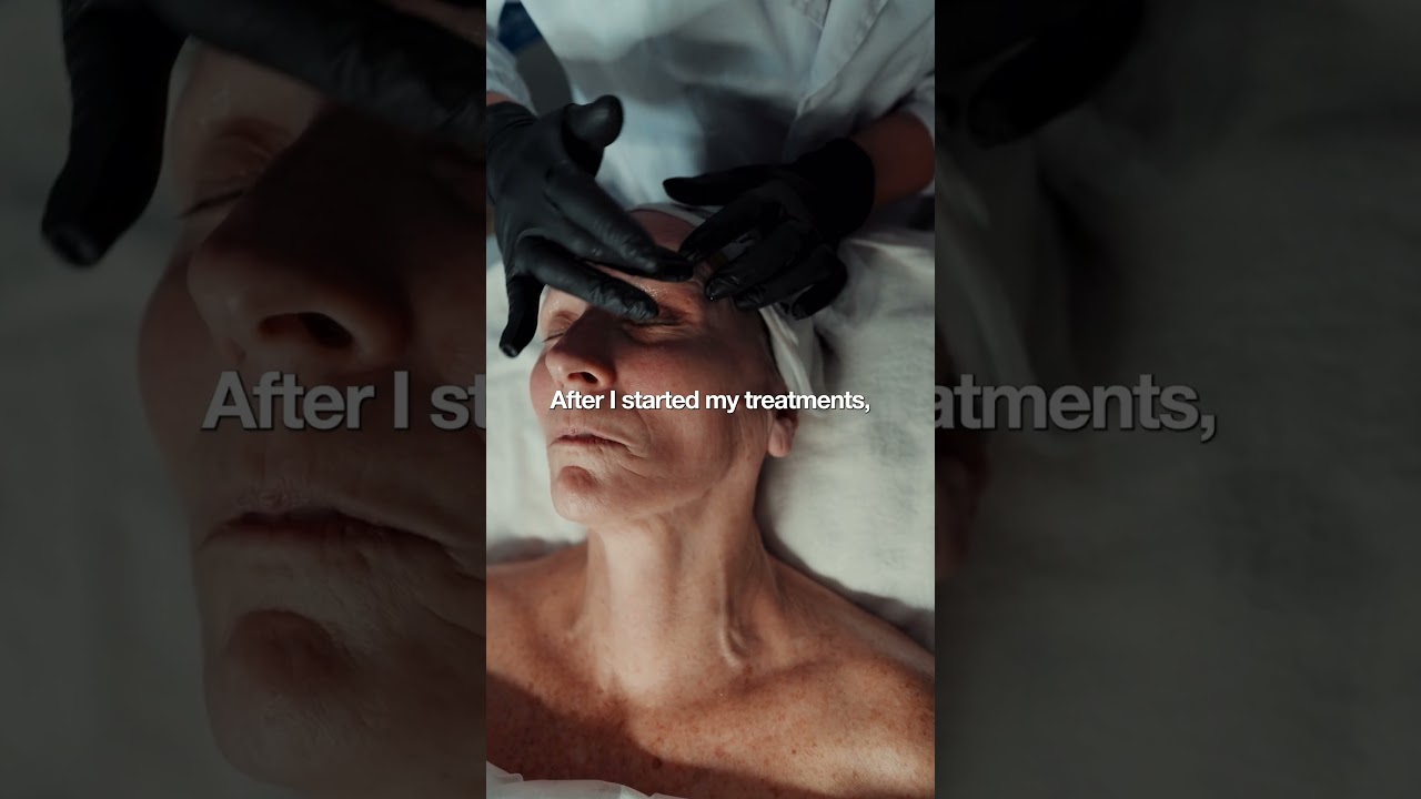Hydra Facial Testimonial