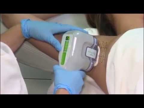 Toronto Plastic Surgeon Explains MiraDry on ET Canada | SpaMedicaTV
Video Thumbnail
