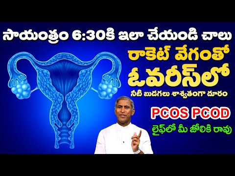 PCOS 😱 PCOD 😩 రాకెట్ వేగంతో ఓవరీస్ లో నీటి బుడగలు శాశ్వతంగా దూరం | Dr Manthena Satyanarayana Raju