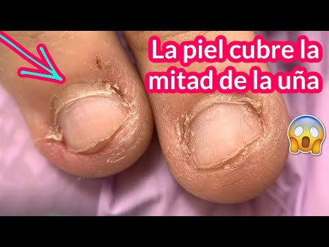 Piel que cubre la UÑA 😲 Transformación de uñas mordidas | Cómo Usar El Pincel Acrílico