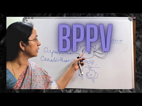 026. Benign Paroxysmal Positional Vertigo  #BPPV