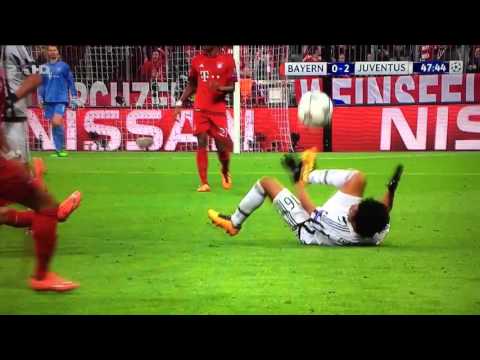 Vidal fight Bayern Juventus 16/03/2016