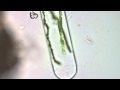 Spirogyra - Filamentous Green Algae 