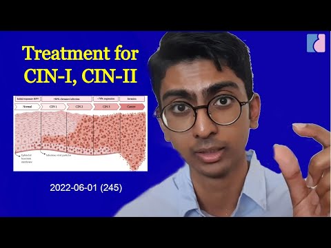 Effective Treatment for CIN-I, CIN- II (Prevention of Cervical Cancer) - Antai Hospitals