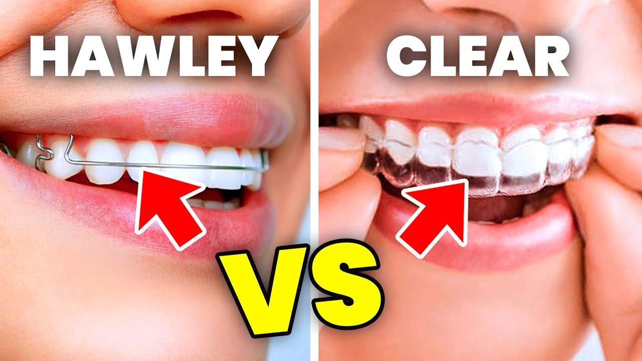 Which Retainer is Right for You? Hawley Vs Clear | Retainers 101