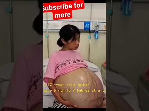 A 32 years old mother give birth 9 baby 😘😘😘😘😘😘😘😘♥️