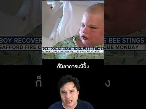 น้องรอดชีวิตจากผึ้งรุมต่อยด้วยพลังจาก 