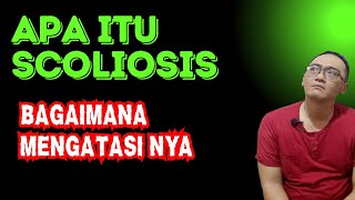Download lagu What is scoliosis and how to treat it mp3 Download lagu What is scoliosis and how to treat it mp3